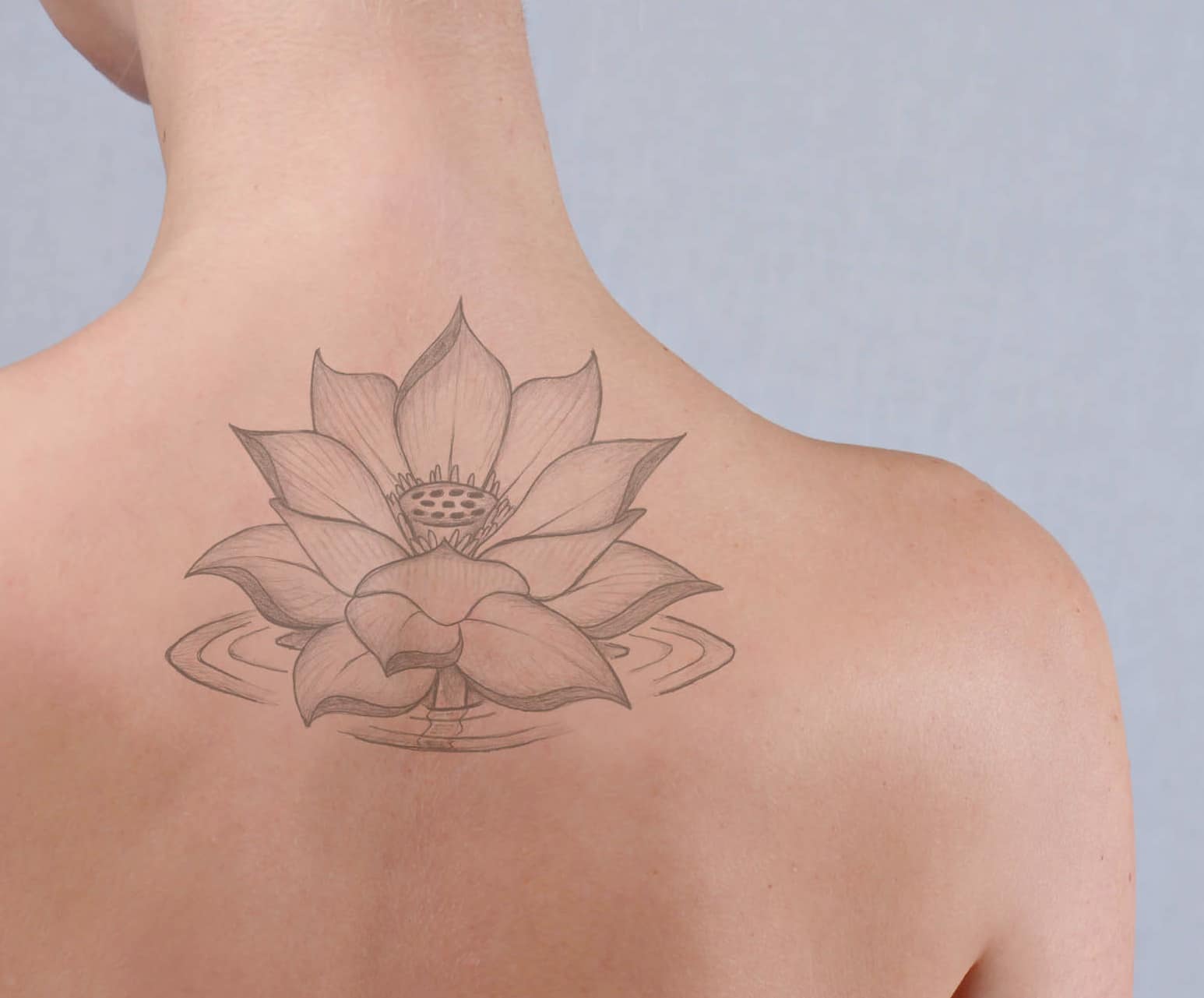 Mujer de espaldas con un tatuaje que se está borrando