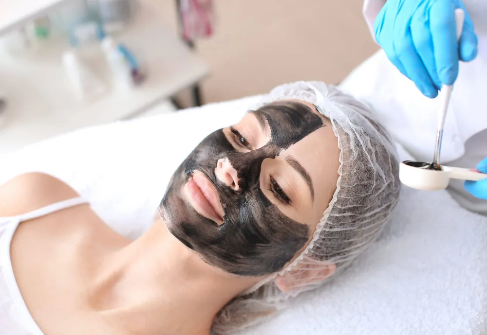 Femme allongée avec un masque noir au carbone sur le visage pendant un carbon peel
