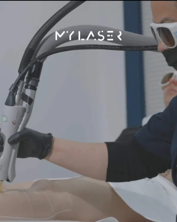 Séance d'épilation laser chez My Laser