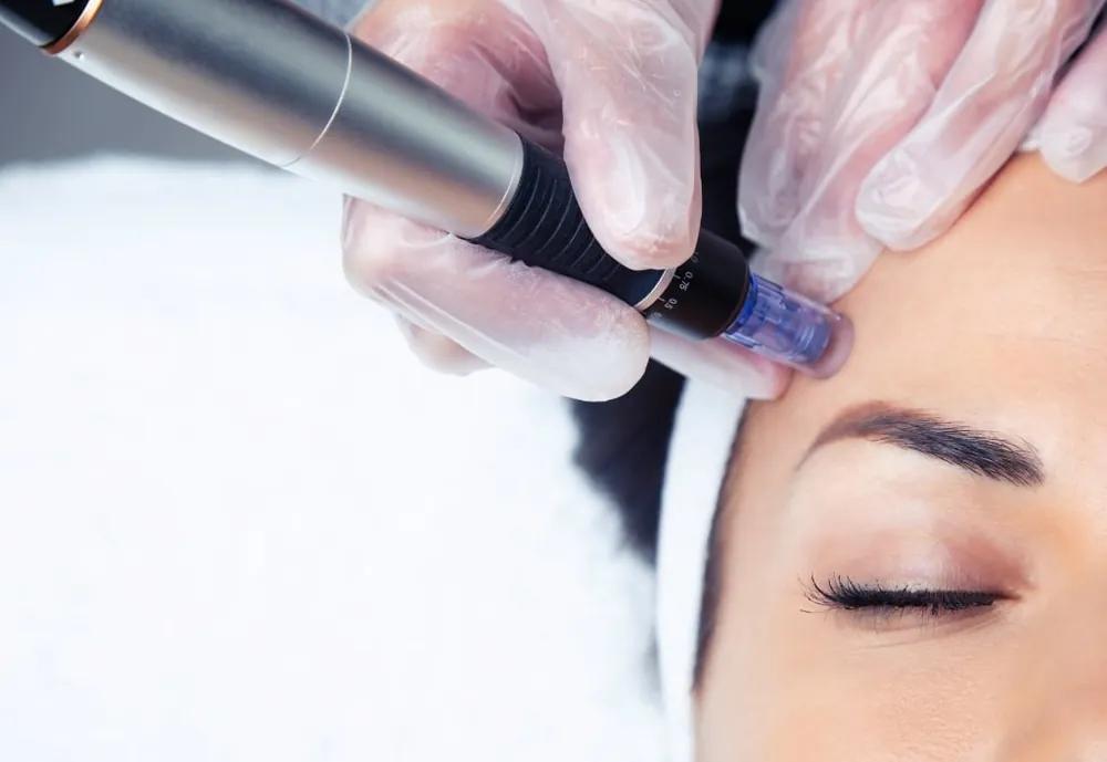 Femme souriante au teint lumineux, mains posées sur les joues après un soin du visage