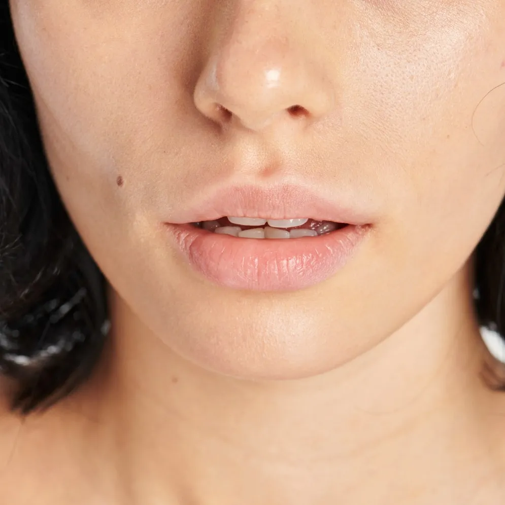 Lèvres en gros plan, avant un lips bleaching