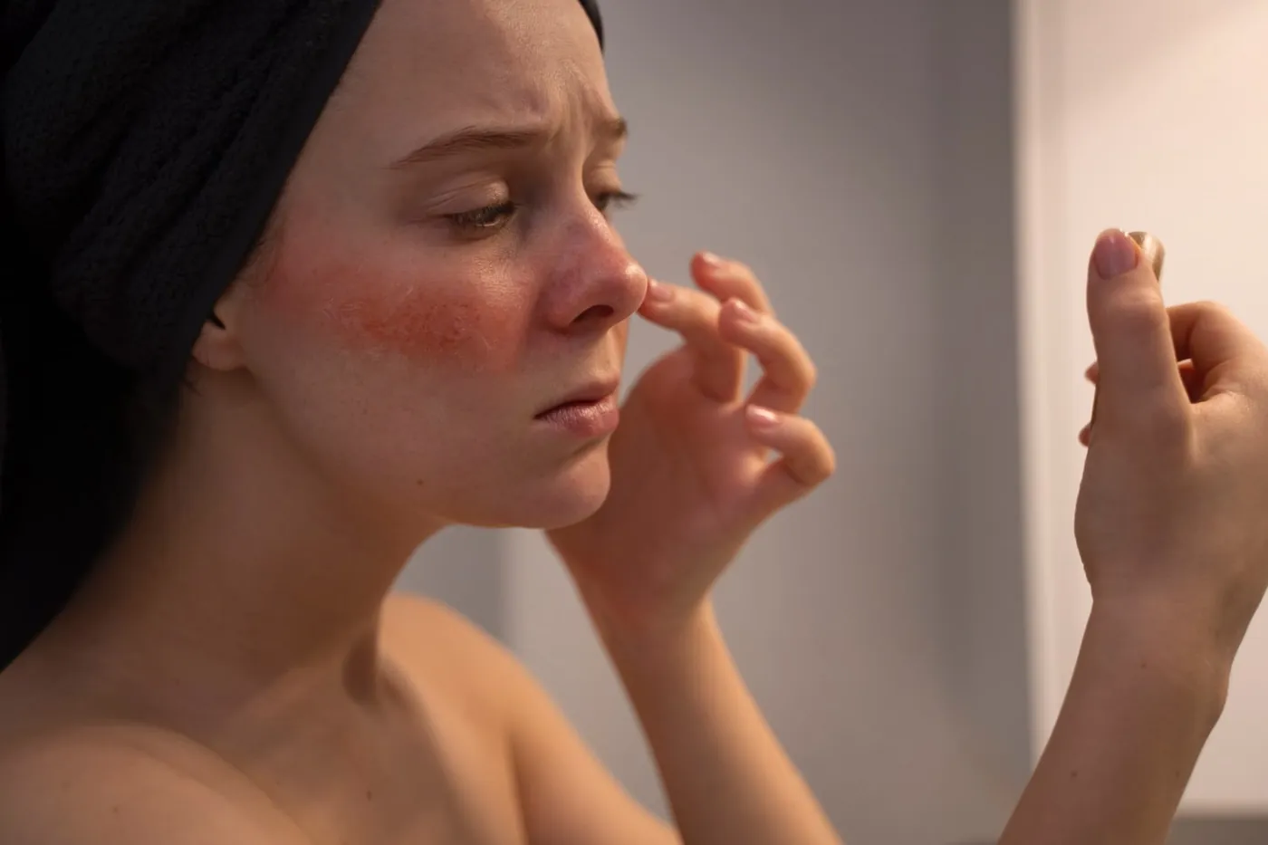 Femme qui touche sa joue marquée de rougeurs diffuses de couperose