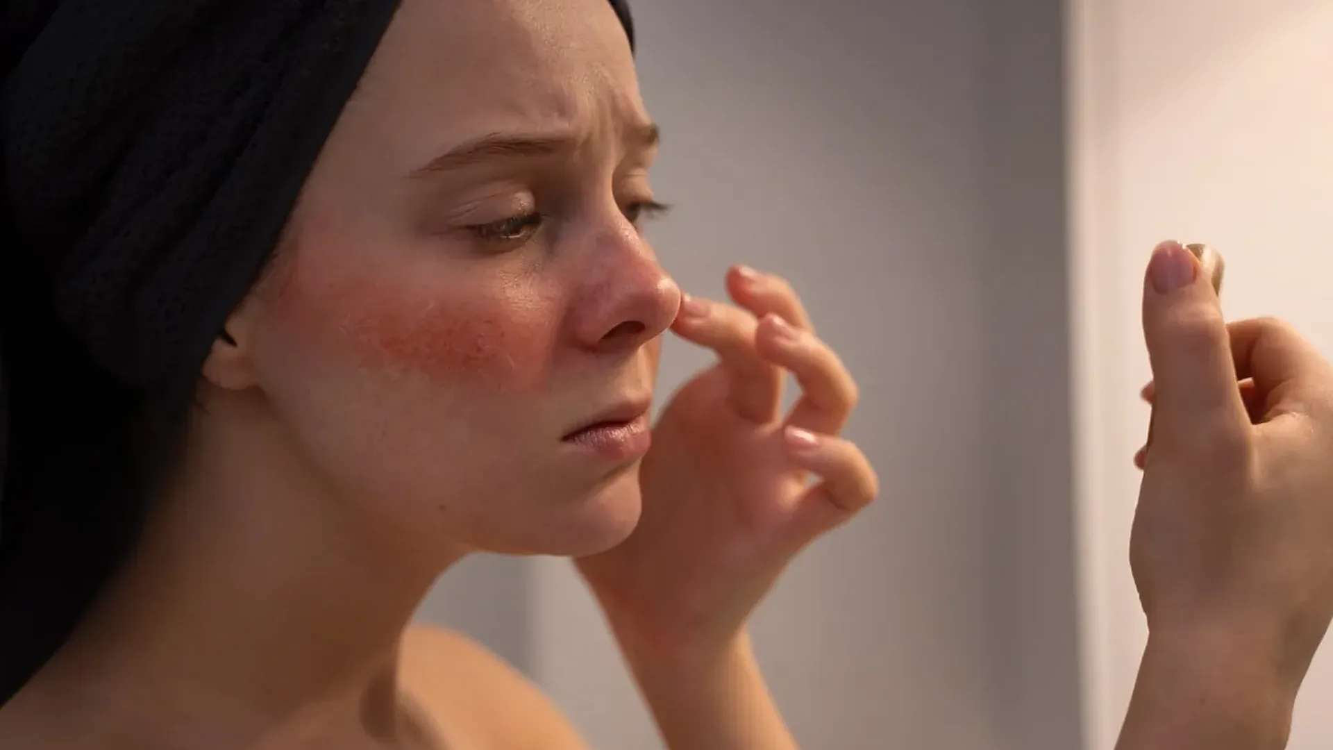 Femme qui touche sa joue marquée de rougeurs diffuses de couperose