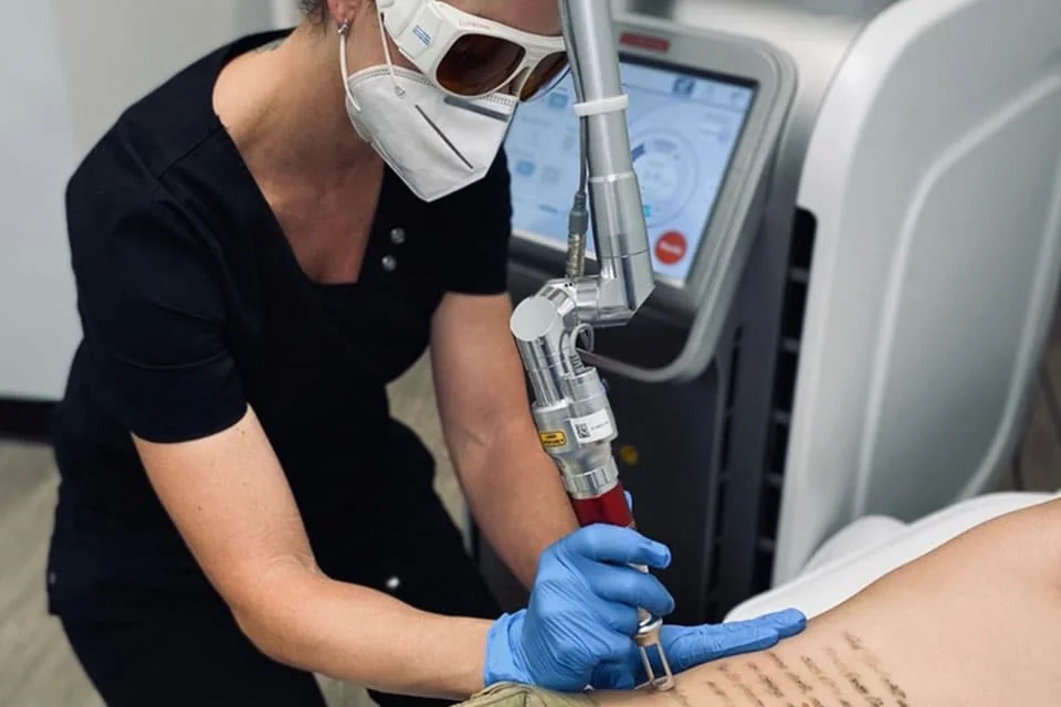 Praticienne en blouse noire, lunettes de protection et gants, appliquant la pièce à main du laser de détatouage sur l'avant-bras tatoué d'une patiente