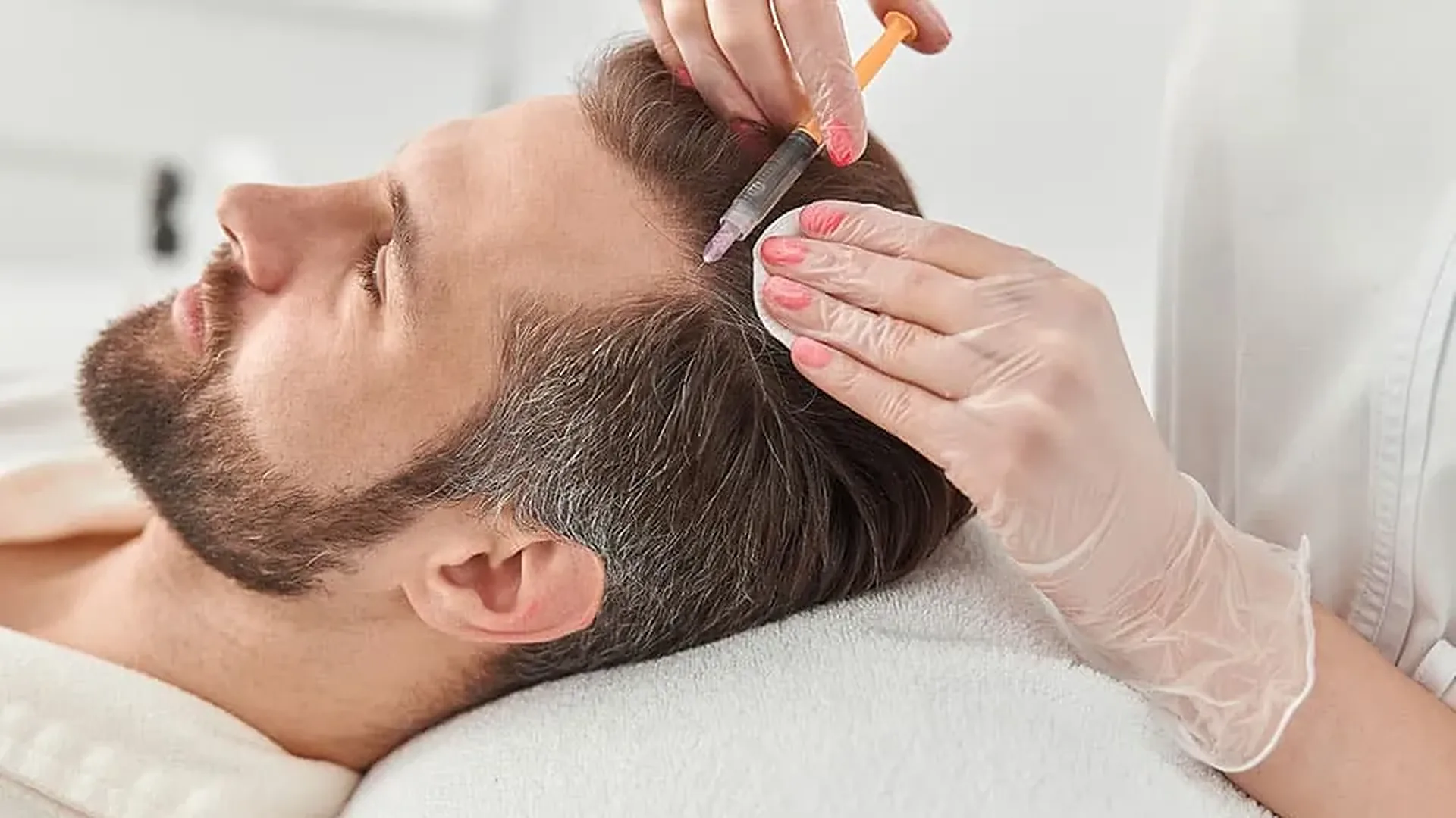 Injection de PRP au cuir chevelu d'un homme allongé, seringue fine tenue par une main gantée